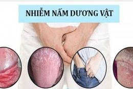 cach-chua-nam-candida-o-duong-vat-nam-gioi