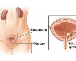 dau-hieu-cua-benh-viem-nieu-dao