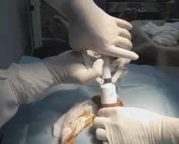 tien-si-bac-si-vu-dinh-cau-chia-se-ve-dau-hieu-nhan-biet-viem-bao-quy-dau-va-cach-dieu-tri