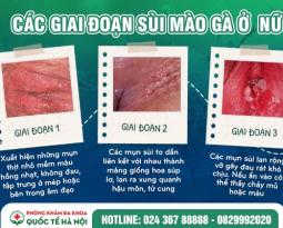 thuoc-chua-sui-mao-ga